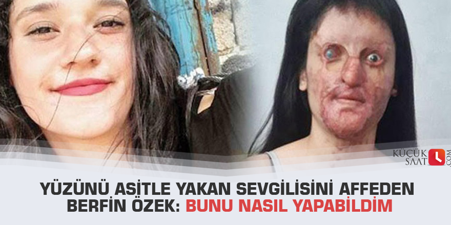 Yüzünü asitle yakan sevgilisini affeden Berfin Özek: Bunu nasıl yapabildim