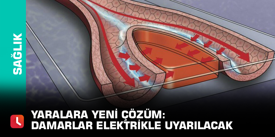 Yaralara yeni çözüm: Damarlar elektrikle uyarılacak