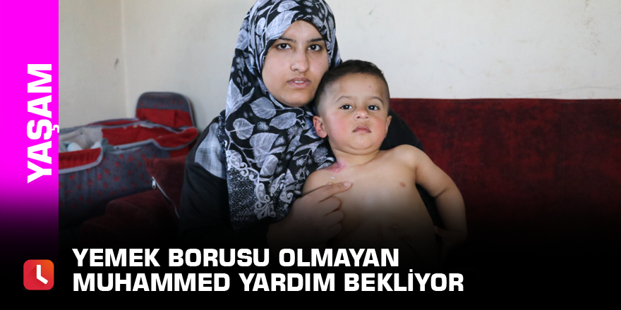 Yemek borusu olmayan Muhammed yardım bekliyor