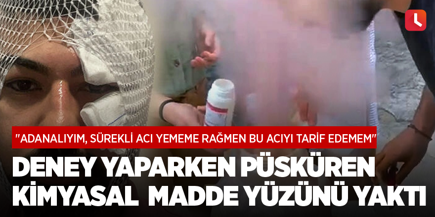 Deney yaparken püsküren kimyasal madde yüzünü yaktı