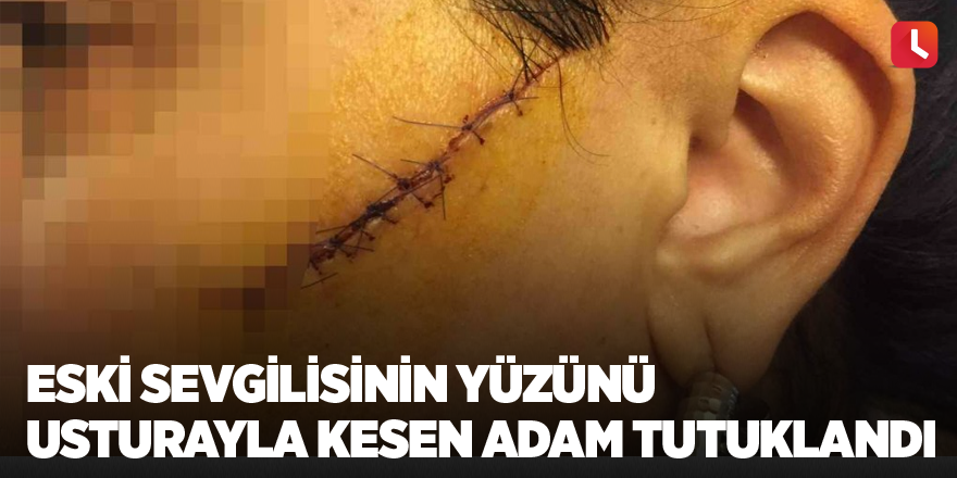 Eski sevgilisinin yüzünü usturayla kesen adam tutuklandı