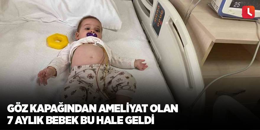 Göz kapağından ameliyat olan 7 aylık bebek bu hale geldi