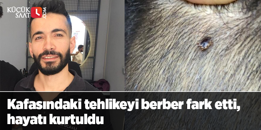 Kafasındaki tehlikeyi berber fark etti, hayatı kurtuldu