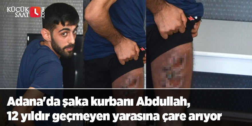 Adana'da şaka kurbanı Abdullah, 12 yıldır geçmeyen yarasına çare arıyor