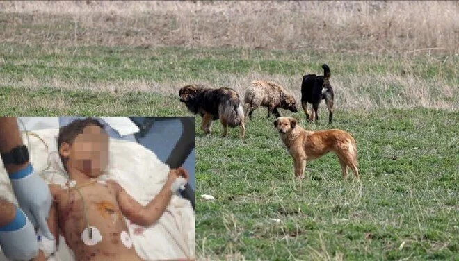 Adana'da 5 yaşındaki çocuğa köpek saldırısı: Durumu ağır