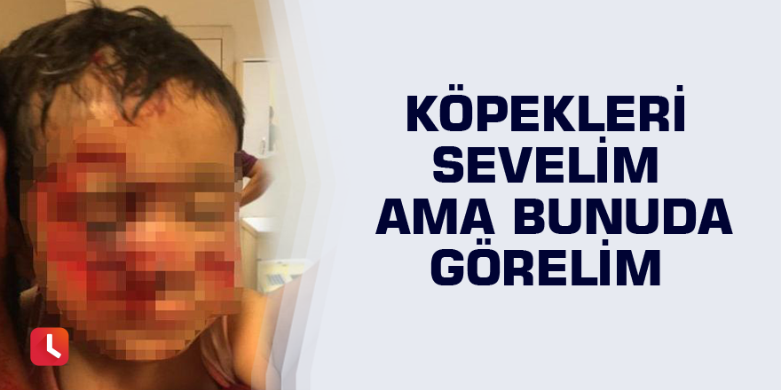 Köpekleri sevelim ama bunuda görelim