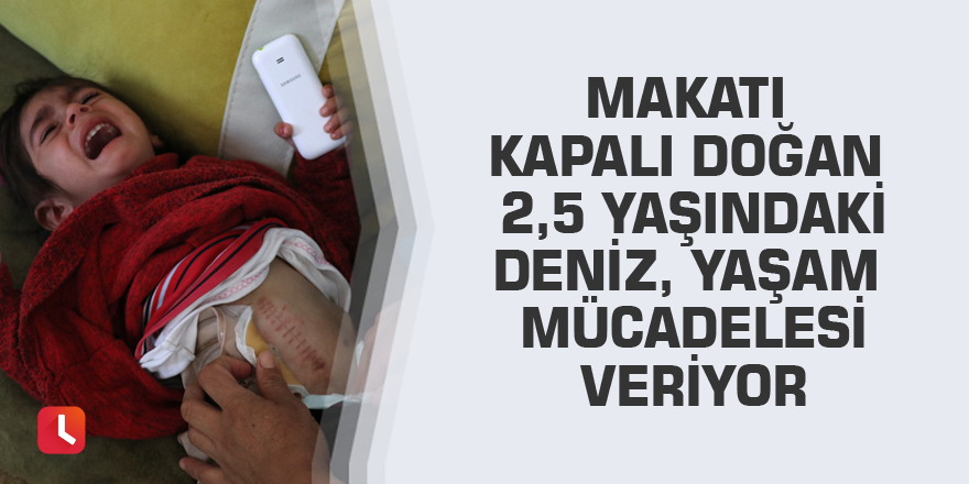 Makatı kapalı doğan 2,5 yaşındaki Deniz, yaşam mücadelesi veriyor