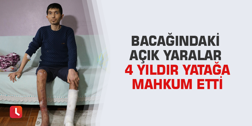 Bacağındaki açık yaralar 4 yıldır yatağa mahkum etti